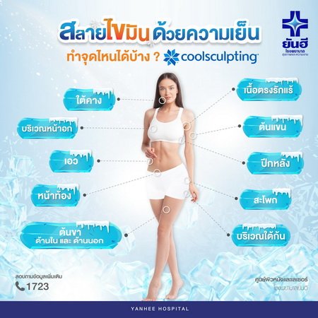 Yanhee Promotion Coolsculpting